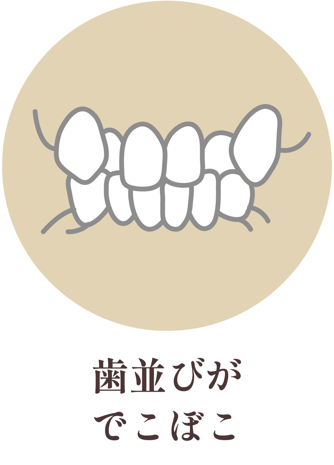 歯並びがでこぼこ